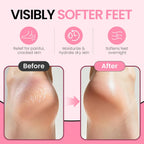 SoftStep™ | Magic Gel Socks ✨